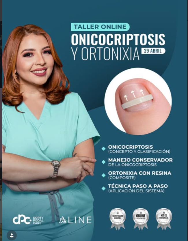 Taller online de onicocriptosis y ortonixia